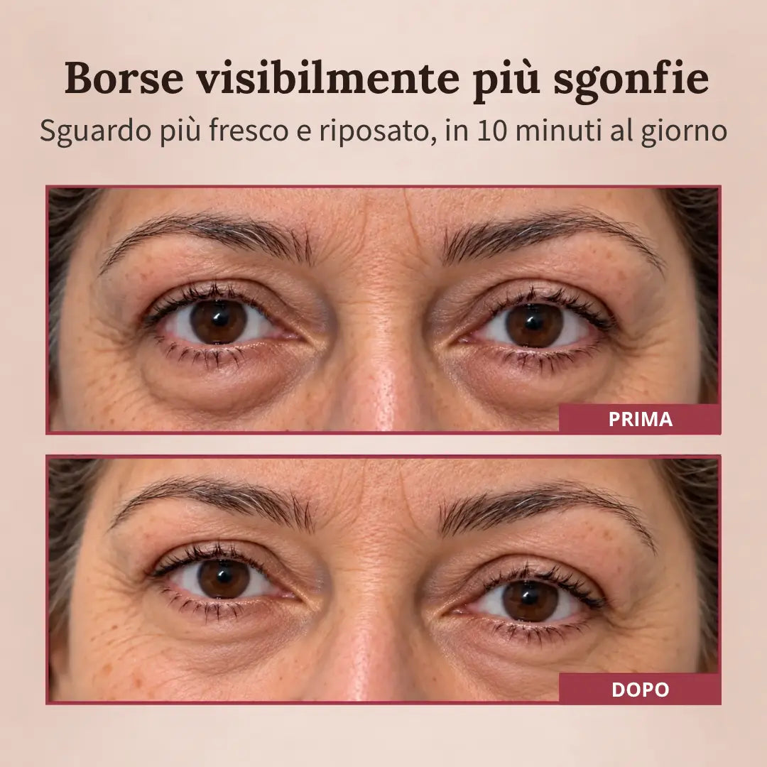 LumiLift®