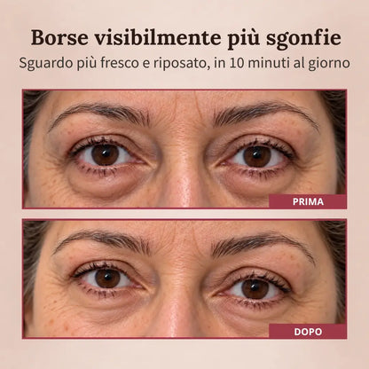 LumiLift®