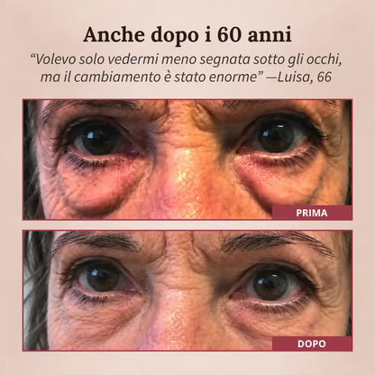 LumiLift®